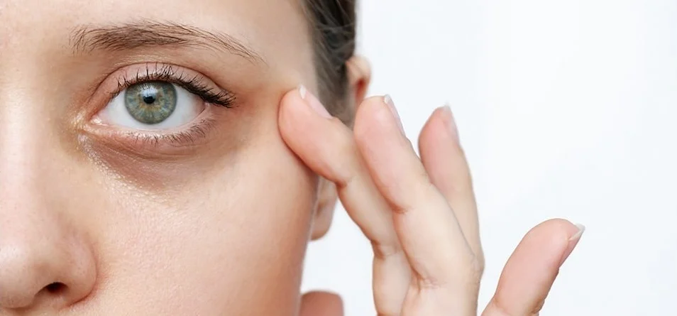 Driving Local Engagement: How Geofencing Boosted Foot Traffic for Legacy Eye Care